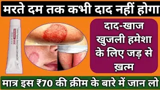 मरते दम तक दाद-खाज खुजली नहीं होगी || dad ki dawa || dad ki dawa cream || dad khaj khujali ki dava