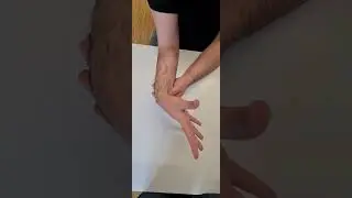 tendon transfer for radial palsy