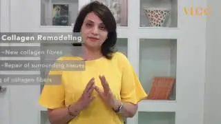 Remove sagginess and get the perfect arms with VLCC 1