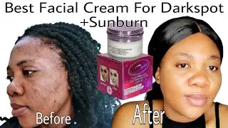 VEETGOLD WHITENING FACE CREAM REVIEW || Remove Sunburn, Dark spot, Wrinkle with Veetgold Face Cream
