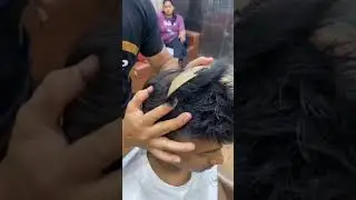 Clip On Hair Patch for Men | Instantly Regain Your Confidence with Natural-Looking Hair Solutions!