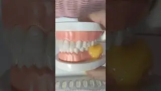 Eats Yellow Jelly| #shortsvideo #teeth #jelly #toothbites#foodcrush #crushing