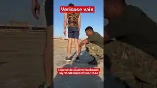 Varicose vain medical problems || army medical test