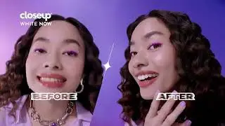 Gigi Putih Dari Sikatan Pertama Dengan Closeup White Now!