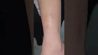 Spot Diagnosis #imwell
