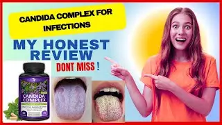 Watch Candida Complex Reviews: Side effects, Benefits, Uses, & Warnings