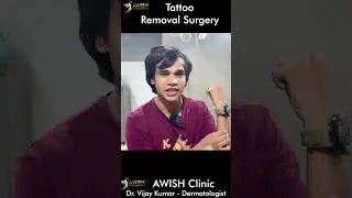 Tattoo removal surgery review by patient | important message for students #army #tattoo #surgery