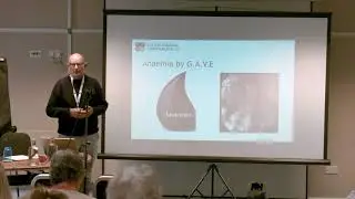 Michael Corbett talks about his story of scleroderma at SRUK Annual Conference 2017