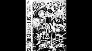 Suppurated Fetus - The Rest of Nothing - demo 1990