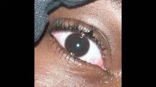 EYES | PROD. PRODWILLY