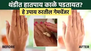 थंडीत त्वचा काळी पडण्याची भीती सोडा, हे मॅजिकल उपाय करून बघा | Transform Winter Skin: Remedies GA2