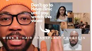 Week 9 - Hair transplant progress. I went to Heva clinic in Istanbul turkey
