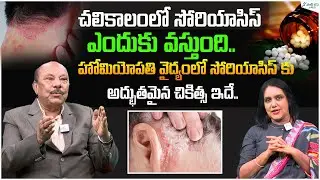 How to Control Psoriasis During Winter? | Psoriasis Treatment by Homeopathy | Dr. Venkateswar Rao