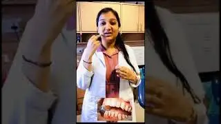 How to remove food stuck between your teeth or gums: Toothpick❌ or Interdental brush✅