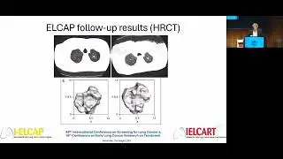 06d   Evolution of CT - Transition from Single Slice Helical to Photon Counting