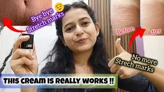 Best stretch marks cream | throveco stretch marks cream review| thriveco stretch marks cream