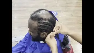 How to Braid over extreme hair loss #shorthairbraids  | My Grip Game