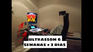 Ultrassom 6 semanas e 3 dias
