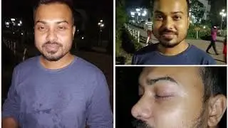 Huawei Honor 8X low light & night performance watching on AKTechBD
