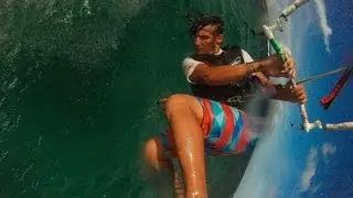 How GoPro Managed to Beat Analyst Estimates