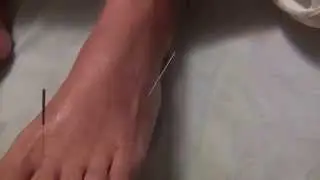 Marma-vidya. Вращение аккупунктурных игл в каналах нади. Priyanka.