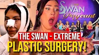 The Swan [2004] - EXTREME plastic surgery TV SHOW | ALEXIS BLAKE REACTS