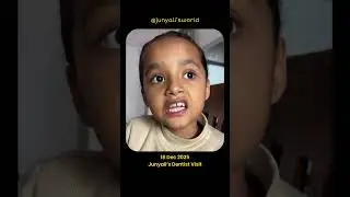 Today I visited Dentist for toothache #junyali #cutekids #kidstooth #toothacheremedy #littleteeth