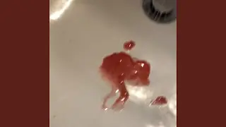 Rabbit Hole