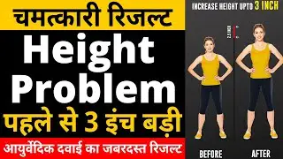 height badhane ka tarika | exercises to increase height | increase height after 21 |  height|