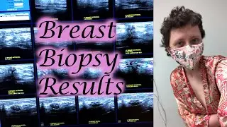 BIOPSY & MRI RESULTS May 2020 | Cancer Adventures Vlog