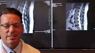 From Pain to Relief: A Herniated Disc Success Story