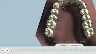 Exceed and CEREC Ortho