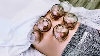 Inner Qi Wellness Center &mdash; Cupping Therapy Session