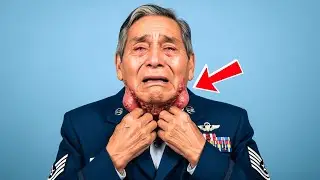 Veteran Thought They Were Just Pimples&mdash;What Doctors Found Left The Military In Panic!