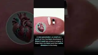 Grain-Sized Wireless Pacemaker That Dissolves in the Body &ndash; A Medical Game-Changer! 💓⚡