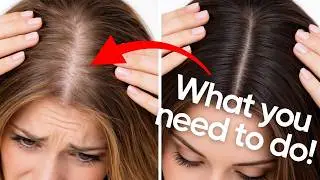 Why Your Hair Is Falling Out and How To Stop Hair Loss FAST