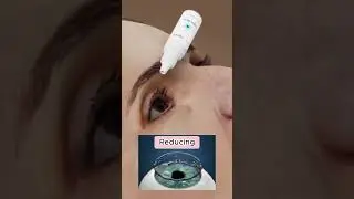 Natural eye color changing is now easy with Fancy Drops color changing eye drops.🥰💯 #youtube #fyp