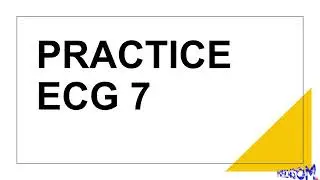 PRACTICE ECG 7
