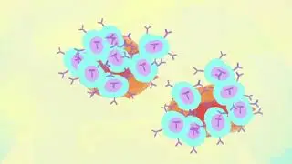 Dr. Susan Love Research Foundation - CAR-T Explained - Whiteboard Animation
