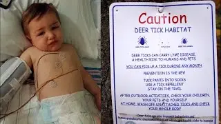 How to Stay Safe From Tick Bites