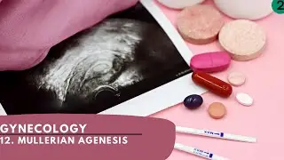 Gynecology- 12. Mullerian agenesis|Primary amenorrhea|Mackler