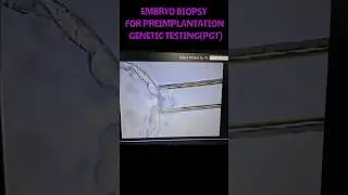 Embryo Biopsy for Preimplantation Gentic Testing (PGT) #ivf #viral