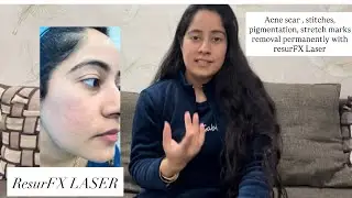 Stitches marks removal laser pigementation remove acne scars removal pimples marks or pits removal 