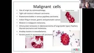 CDE Series (2) : Body Fluids Apart From Routine - Cytopathology