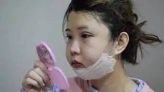 [BANOBAGI] My First Plastic Surgery in KOREA Part2 CONSULTATION BEAUTIQUE KOREA BANOBAGI CLINIC