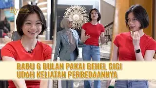 6 BULAN PAKAI BEHEL, GIGI NADA CORBUZIER JADI JAUH LEBIH RAPIH