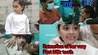 Teeth extraction || पहिलो दात फाइदा को त्यो रुवाबासी 😢|| Aarohi adhikari