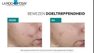Ontdek EFFACLAR Serum - Bewezen doeltreffendheid