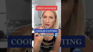 Worst side effect from Cool Sculpting! #coolsculpting #cosmeticprocedures