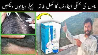 sebornil shampoo uses | medicated shampoo | dandruff shampoo | khoskee kase khatam kare | sebornil